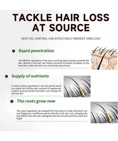 Hair Growth Oil Deeply Nourishing Scalp Enhance Natural Hair Growth Intensity Hair Growth Serum for Repairs Hair Follicles Anti Hair Loss Nourishes Dry Damaged Hair - Buy Online on GoSupps.com
