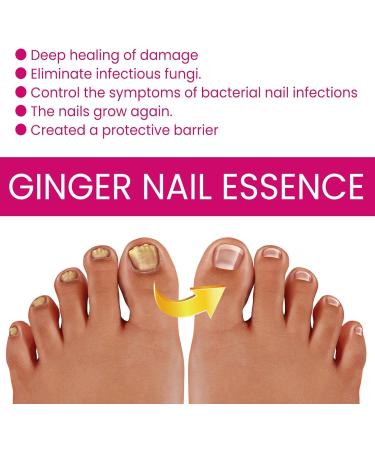  G n rique Nail Hardener Nails Nutrient Oil 10ml Natural Cuticle Oils Repair Softener Optimal Nail Revitalization for Foot Care Fingernails Yellow Toenail Ingrown Women and Men - Buy Online on GoSupps.com