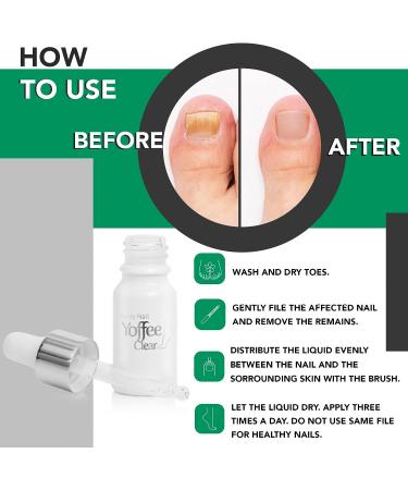 Yoffee Clear Nail Care - Anti Fungal Treatment for Finger and Toenails - 10 ml - Antibacterial - Made in Spain - Organic Argan Oil & Tea Tree Oil - Buy Online on GoSupps.com