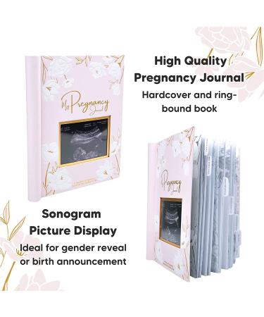 Pregnancy Journal - 80 Pages Hardcover Pregnancy Book for Mom to Be Gift - Pregnancy Announcements & Gifts for New Moms - Baby Album & Memory Book - Blossom Design - Buy Online on GoSupps.com