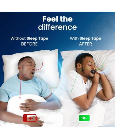 30 Napify Sleep Tape | Stop Snoring Promote Nasal Breathing Gentle Pain-Free Strips for Optimal Rest & Recovery - Hypoallergenic - Buy Online on GoSupps.com
