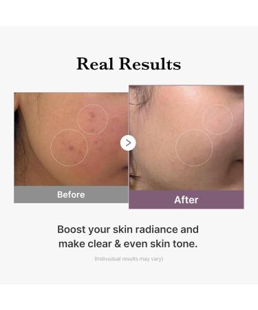 medicube Age-R Glutathione Glow Milky Toner Low-Irritation Double Layer Toner for Glass Glow Skin with Peptide Even Skin Tone Radiance Hydration Korean Skincare - Buy Online on GoSupps.com