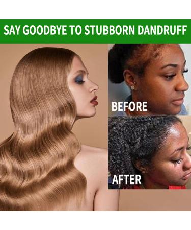 Moisturizing Hair Oil30ml Travel Size Hair Nourishing Oil Refreshing Scalp Care for Men Women Teens Family - Buy Online on GoSupps.com