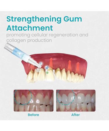 Taileden Gum Therapy Gel Taileden Gum Therapy Gel for Recessed Gums Taileden Gum Care Gel Gum Shield Therapy Gel Gum Therapy Gel Teeth Whitening Essence Pen (5PCS) - Buy Online on GoSupps.com