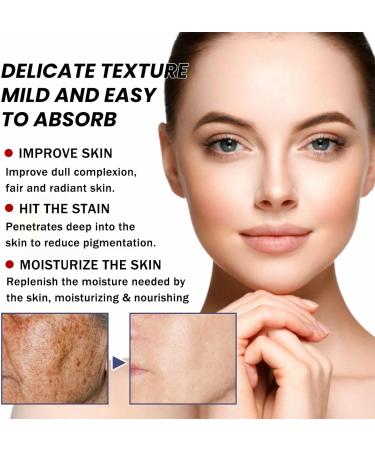 Dark Spot Remover for Face Niacinamide Acid & Arbutin Spot Cream Dark Spot Correcting Glow Serum Age Spot Remover for Face Freckle Removal Cream to Even Skin Tone Fade Melanin - Buy Online on GoSupps.com