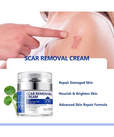 Uocasi Scar Removal Cream Scar Remover Treatment Butter Skin Repair Cream for New and Old Scars Effectively Repairs Facial Skin Cuts Stretch Marks Surgical Scars 50ML - Buy Online on GoSupps.com