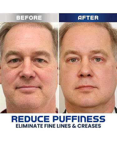 5 Pcs Men Eye Cream Tender Men Eye Gel Eye Gel for Lines Remove Puffiness Dark Circles Eye Lines with Hyaluronic Acid Centella Asiatica Extract Repair Sye Skin for Men Jildouf - Buy Online on GoSupps.com