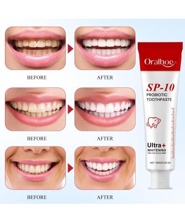Sp-10 Ultra Whitening Toothpaste Ultra Whitening Sp-10 Probiotic Toothpaste Lightening Sp-10 Sp 10 Ultra Whitening Toothpaste Sp-10 Ultra Whitening Toothpaste Sp-10 With Toothbrush - Buy Online on GoSupps.com