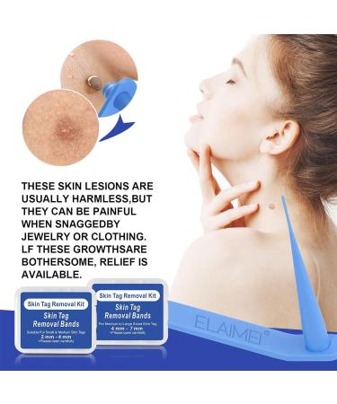 Skin Tag Removal Two-Strip Fast Auto Tag Removal Kit Skin Tag Repair with 40 Elastic Bands for Face Neck - Buy Online on GoSupps.com
