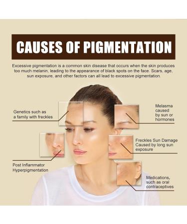 KOAHDE Freckle Removal Cream For Face Freckle Cream Anti Melasma Facial Moisturize Cream Moisturizing Anti-Blemish Cream Pigmentation Removal Cream for Face Skin Brightening Cream Dark Spot Corrector - Buy Online on GoSupps.com