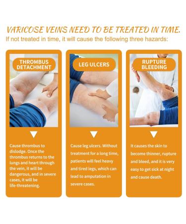 Vitamin K Cream for Varicose Veins - Miracle Cream for Spider Veins & Leg Vein Removal (1pcs) - Fast International Shipping - Buy Online on GoSupps.com