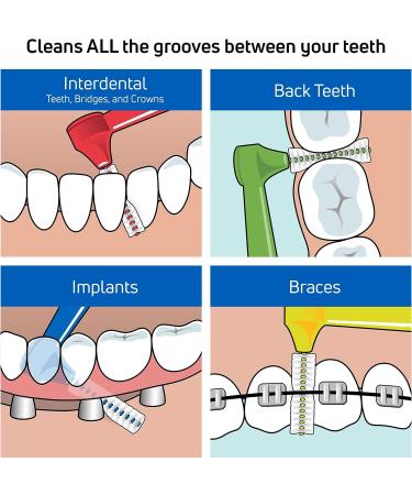 Tepe Angle Interdental Brush 0.7mm 25 Pack Yellow Yellow 1 count (Pack of 1) - Buy Online on GoSupps.com