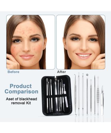 FANMAOUS 8pcs Pimple Popper Tool Kit Blackhead Remover Tools Blackhead Extractor Pimple Extractor Pimple Popper Tool Zit Popper Tool Acne Tools Comedone Extractor Black Head Remover for Face - Buy Online on GoSupps.com