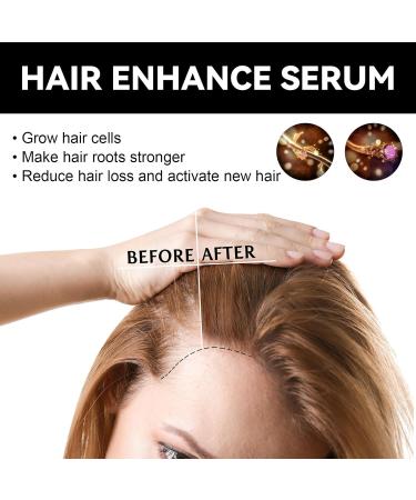 Strawberry Mint Growth Oil Strawberry Mint Hair Growth Oil Natural Rosemary Hair Essential Oil Strawberry Oil for Hair Growth Strawberry Essential Oil Rosemary Oil for Hair Growth & Skin Care 1 - Buy Online on GoSupps.com