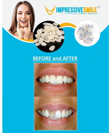 Ultra Thin Tooth Whitening Veneers for Missing or Broken Teeth | Realistic Cosmetically Enhanced Smile | Shade A-2 - Buy Online on GoSupps.com