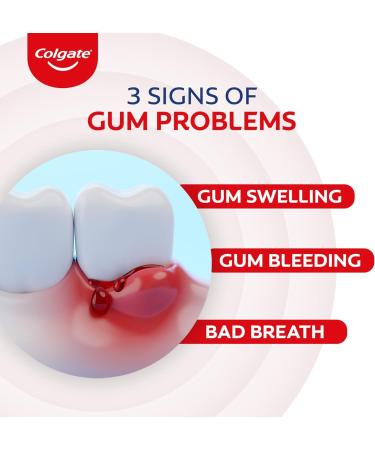 Colgate Gum Protection PerioGard Toothpaste 90g - Fight Plaque & Keep Gums Healthy | International Shipping Available - Buy Online on GoSupps.com