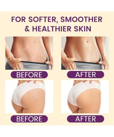AOAO Shea Body Butter for Stretch Marks Pregnancy with Honey & Coconut - Shea Butter Body Balm & Body Butter for Pregnant Women - Hypoallergenic Nourishing Body Moisturizer (Shea Butter) - Buy Online on GoSupps.com