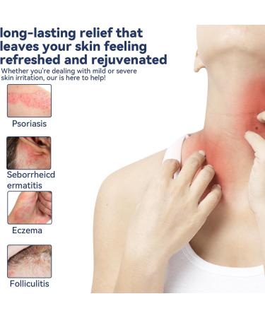 Buy Manuka Honey Eczema Balm - Soothing Relief for Psoriasis Rashes & Itchy Skin - Natural Remedy for Adults & Children - Buy Online on GoSupps.com