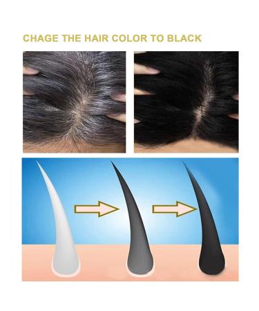 Chinese Grass Scented Anti-Hair Loss Shampoo & Oil for Dandruff Control | Quick Hair Growth & Strengthening | International Shipping Available - Buy Online on GoSupps.com