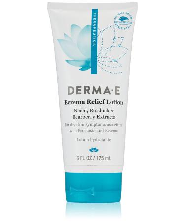 DERMA-E Eczema Relief Lotion – Itchy Skin Rescue Cream – Soothing Eczema Cream Relieves Flaky Scaly and Dry Skin - Topical Eczema and Psoriasis Cream 6 Fl Oz