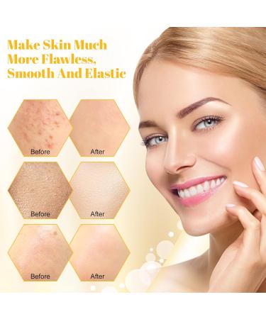 Buy Honey Face Mask - Tightens Pores Deep Cleans & Moisturizes Skin - International Shipping Available - Buy Online on GoSupps.com