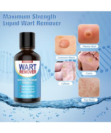 Aisisree Wart Remover  Warts Removal Stielwarts Spinous Foot & Hand Wart Agent Gentle and Irritation - 0.5 Oz - Buy Online on GoSupps.com