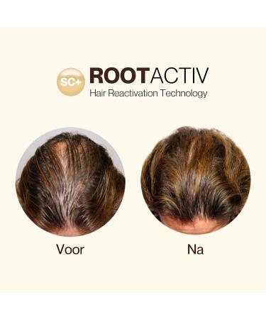 TEITV Stem cell hair growth serum for women and men Natural Hair Growth Treatment Reduces hair loss 75 ml - Buy Online on GoSupps.com