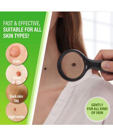 Memonotry Skin-Tag-Remover-Serum 30.00ml - Extra Strength Treatment for Skin Tags & Warts - Painless & Safe Removal - Pack of 1 - Buy Online on GoSupps.com