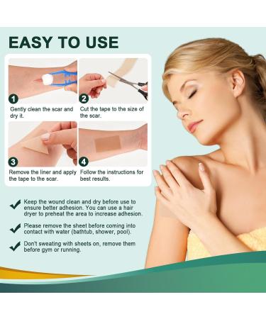 Surgical Scar Treatment Silicone Tape - Reusable Medical Grade Sheets for Keloid & Acne Scars (1.6 x 120 Roll) - Buy Online on GoSupps.com