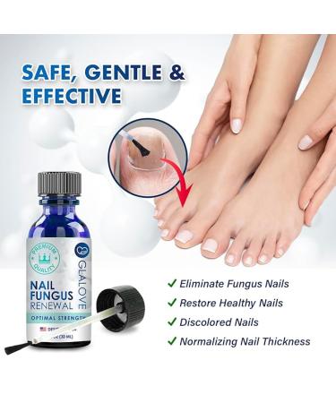 Toenail Fungus Treatment Extra Strength: Fungus Nail Treatment Fast Acting - Nail Fungal Treatment for Toenail and Fingernail - Nail Fungus Treatment for Men & Women - 30ML - Buy Online on GoSupps.com