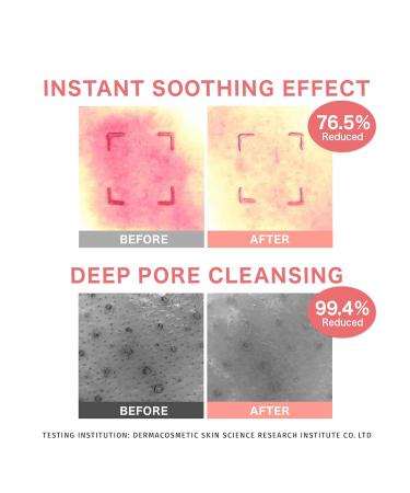 Barrier Enhancing Cleanser | Vegan Korean Skincare for Sensitive & Dry Skin | Deep Hydration & Oil Control | Pore Cleansing | 6.42 Fl. Oz - Buy Online on GoSupps.com