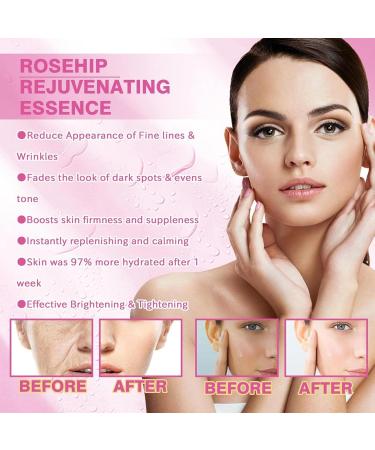 Rose Face Milk Serum Glow Rose Essence Rose Face Care Essence Milk Rose Extract Face Serum Rose Anti Aging Face Moisturizer Rose Face Essence Improve Dull Skin & Soft Skin Tone - Buy Online on GoSupps.com