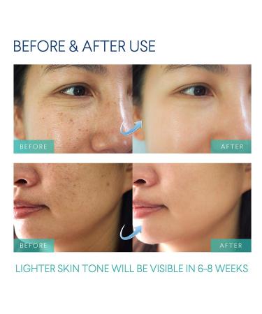 Evagloss Razor Bumps Solution - After-Shave Repair Serum for Ingrown Hairs & Dark Spot Correction | Skin Lightening Roll-On for Men & Women (100g) - Buy Online on GoSupps.com