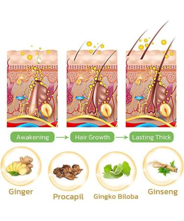 Tosuua Hair Serum Hair Lotion 3Pack for Men Women Growthplus Hair Root Nourishing Ginger Spray 120ml with Massage Roller - Buy Online on GoSupps.com