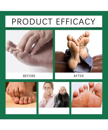 WRANBAO Foot peeling spray with orange oil moisturizing refreshing foot peeling spray peeling foot care sprays for removing dead skin and calluses cracked and rough feet 5 pieces 5 pieces - Buy Online on GoSupps.com
