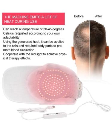 Hair Growth System - 108 Lamp Beads Hat for Men & Women | Oil-Controlled Treatment for Fuller Hair - Buy Online on GoSupps.com
