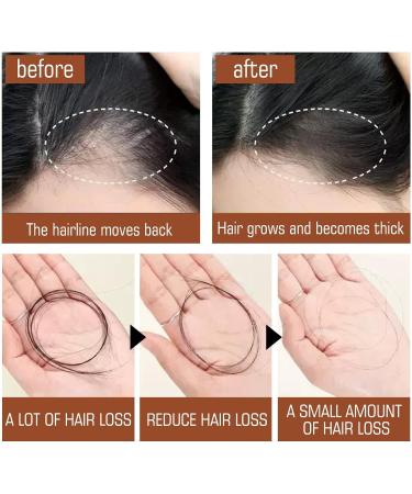 KiJalyelu Batana Oil for Hair Growth and Nourishment Natural Batana Oil for Hair Growth for Healthier Thicker Hair Prevent Hair Loss Promotes Hair Strength - 120ml - Buy Online on GoSupps.com