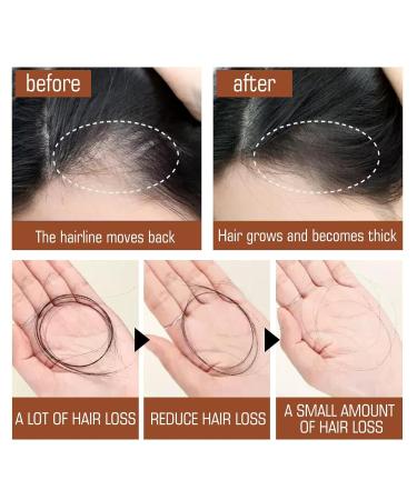 Organic Batana Oil Hair Treatment Conditioner - 120ml | Hair Growth Botanical Extracts & Vitamins for Healthier Thicker Hair - Buy Online on GoSupps.com