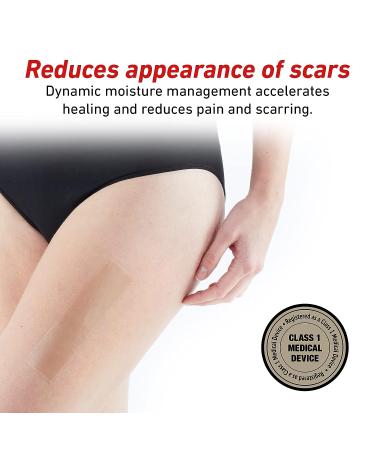 Neo G Opti-Heal Silicone Scar Strips for Surgical, C-Section, Burn, Acne, Keloid Treatment - 6 Strips - 1.6 x 5.9 inch - Medical Grade Scar Sheets - Buy Online on GoSupps.com