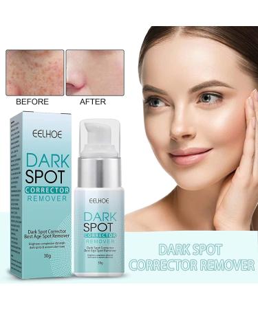 Dark Spot Corrector for Face - 3 Pack Freckle and Discoloration Correcting Serum - Buy Online on GoSupps.com