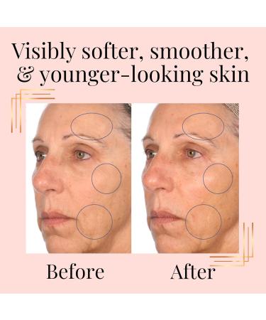 SkinInfusion Facial Oil - Anti-Aging Collagen Serum with Hyaluronic Acid & Vitamin C - Hydrating Oil for Dark Spots & Dull Skin - 150ml (5 oz) - Moisturizing Matrixyl 3000 - Buy Online on GoSupps.com