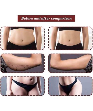 Buy Ear Acupuncture Stickers & Ear Seed Kits for Facial Reflex Massage | Acupressure Set for Pain Relief - Buy Online on GoSupps.com