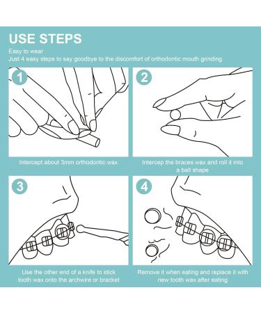 Tooth Wax for Braces - 10 Pre-Cut Pieces Orthodontic Wax Food Quality & Odorless with Storage Box - Perfect for Aligners - Buy Online on GoSupps.com