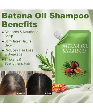 Shampooing Stimulant La Repousse Des Cheveux | Nettoyant Contr le des Huiles 250ml Shampooing Epaississant Soin Salon la Maison pour Cuir Chevelu Sensible Jour et Nuit Types de Cheveux - Buy Online on GoSupps.com