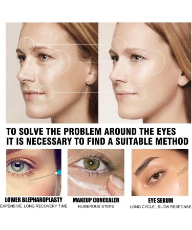 Advanced Peptide Eye Cream Eye Cream for Dark Circles and Puffy Eyes Anti Wrinkle Eye Cream Firming Eye Cream Under Eye Cream Eye Bags Remover Brighten Smooth Hydrating &Firming Eye Serum - Buy Online on GoSupps.com