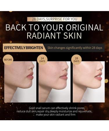 Snail Mucin Essence & Snail Eye Cream with Red Ginseng Face Moisturiser with Hyaluronic Acid Serum Niacinamide Serum Facial Serum for Hydrating Anti-Wrinkle Reduce Dark Circles Under Eyes - Buy Online on GoSupps.com