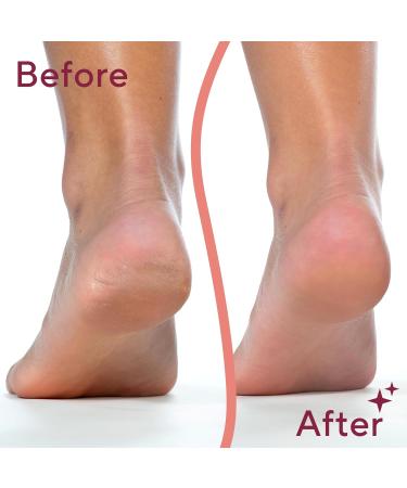 Finishing Touch Flawless Pedi - Electronic Tool File & Callus Remover | New Version - Amazon Exclusive - Buy Online on GoSupps.com