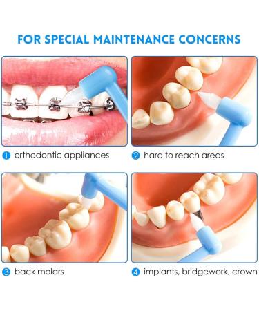 MAQ 12-Part Manual Interspace Toothbrush | Soft BPA-Free Dental Brushes for Orthodontic Bridges | Slim Design for Difficult Areas | Deep Green & White - Buy Online on GoSupps.com