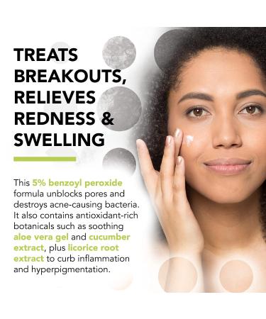 Humane Acne Spot Treatment Gel - 5% Benzoyl Peroxide for Blemish Relief - Aloe Vera and Licorice Root Extract - Vegan & Cruelty-Free - 1 Fl OZ - Buy Online on GoSupps.com