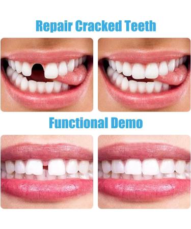 INBOLM 70PCS Temporary Tooth Crown Kit - Front Teeth Fake Tooth Repair Kit - Buy Online on GoSupps.com